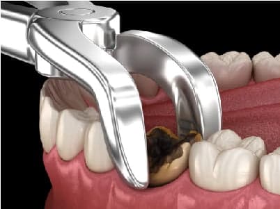 Cirurgia odontológica em Peruíbe — Dra. Camila Meister