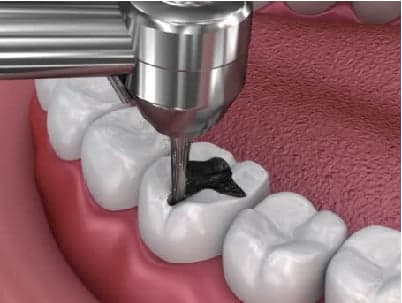 Odontologia estética e restauradora em Peruíbe — Dra. Camila Meister